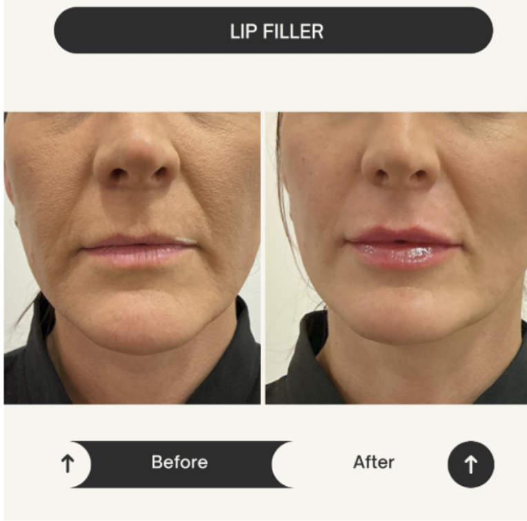 Gallery result 1