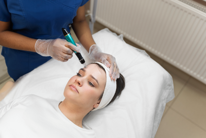 Microneedling treatment — RT Skin Glow Clinic Eastleigh and Verwood