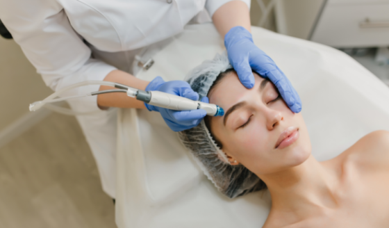 Chemical Peel treatment — RT Skin Glow Clinic Eastleigh and Verwood
