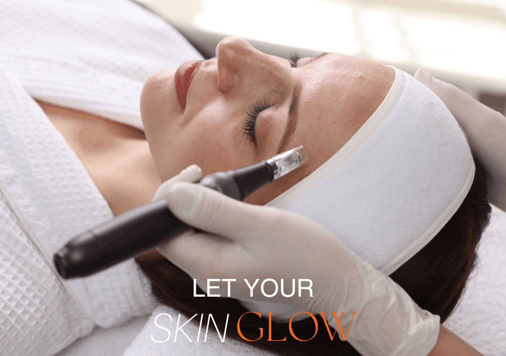 Microneedling treatment in Eastleigh skin clinic