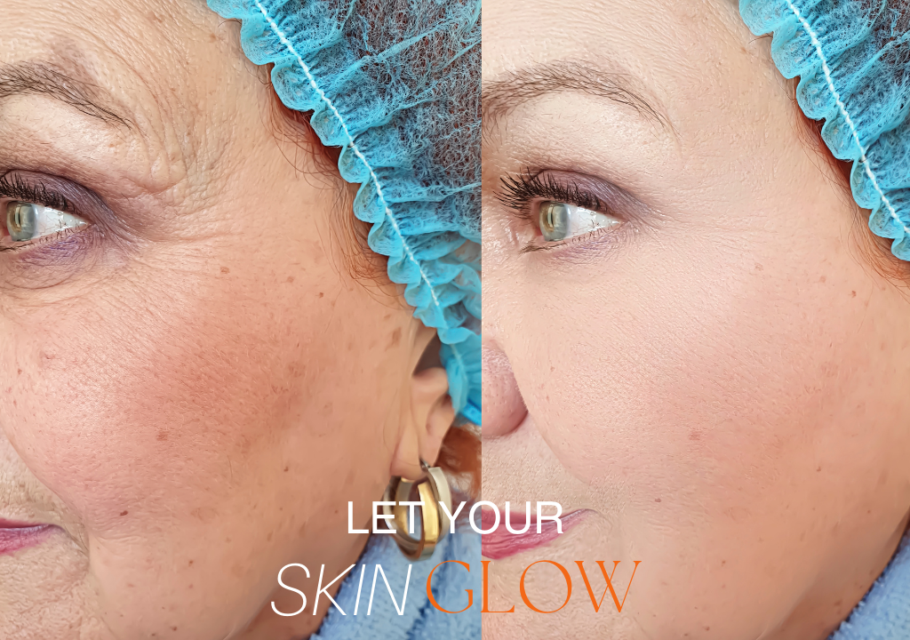 pigmentation-treatment-eastleigh-southampton