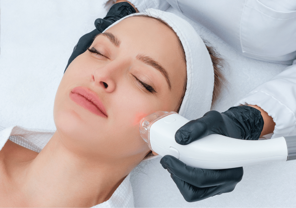 Cryopen Treatment in Eastleigh